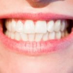 Przepiękne zdrowe zęby również olśniewający cudny uśmieszek to powód do płenego uśmiechu.